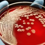 Последствия устойчивости бактерий к антибиотикам могут вызвать пандемию в условиях пандемии. В Lancet опубликовано исследование